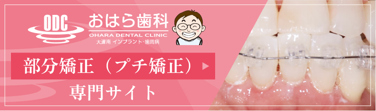 部分矯正（プチ矯正）